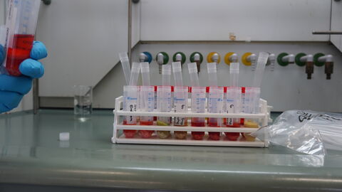 Extrakte während der Aufarbeitung Extrakte während der Aufarbeitung